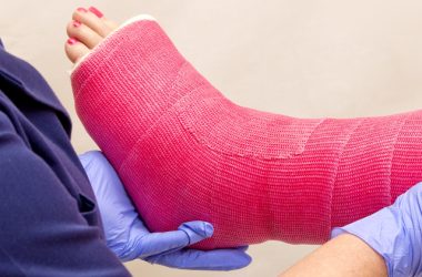 Understanding Orthopaedic Casts: Types, Benefits, and Care Tips