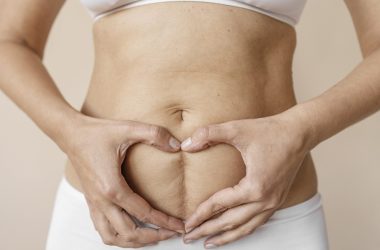 The Importance of C-section and Perineal Scar Tissue Massage